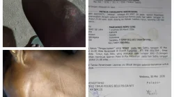 Usai Penutupan Rosario, Marianus Rehu Leki Babak Belur Dikeroyok di Sarabau