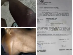 Usai Penutupan Rosario, Marianus Rehu Leki Babak Belur Dikeroyok di Sarabau
